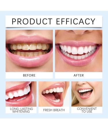 Smilefitpro Peinture de Blanchiment des Dents Vernis Dents Blanc Serr Instant Teeth Whitening Paint Instantan e Eliminer les Taches Oral de Blanchiment Portable Clean Brighten (2PC) - Buy Online on GoSupps.com