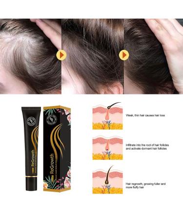 Encomy Roll-On Hair Growth Serum | Organic Regrowth Serum for Women & Men | Prevent Hair Loss & Repair Damaged Follicles - Buy Online on GoSupps.com