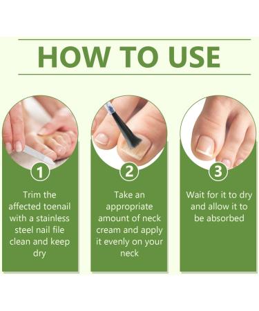 Toenail Care with Nail File Nourishing and Soothing for Nails Promotes the Regrowth of Healthy Nails 30ml - Buy Online on GoSupps.com