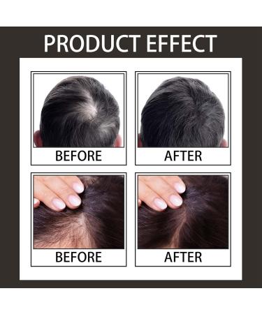 Hairline Powder Hair Shadow Powder for Filling in Thinning Hair Hair Root Dye Touch Up hair powder Hair Root Concealer For Makeup for Men and Women Windproof & Sweatproof with Mirror &Puff (Black) - Buy Online on GoSupps.com