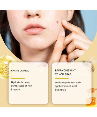 Mole Corrector Skin Blemish Correction Cream Reduces Imperfections 20g Moisturizer Safe for Face Hands Feet and Body - Buy Online on GoSupps.com