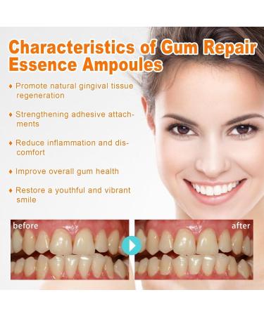  EXQST Cvreoz Gum Repair Essence Blister Tooth Blister Essence for tartar removal - Buy Online on GoSupps.com