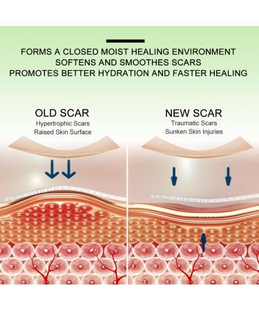 Silicone Scar Sheets Tape Strips 16 Pcs - Keloid C-Section Tummy Tuck Healing - Surgery Scars Treatment - Buy Online on GoSupps.com