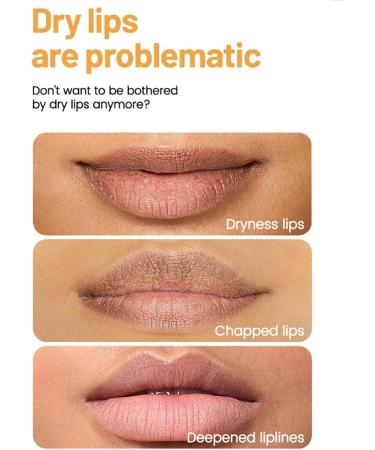 Korean Lip Serum Dark Lip Serum Moisturizing and Nourishing Lip Serum Lips Pink Fresh Treatment Balm for Dry Lips Lighten Lip Wrinkles - Buy Online on GoSupps.com