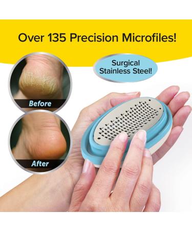 Ped Egg Classic Callus Remover | As Seen On TV | Safely Remove Tough Calluses & Dry Skin | 135 Precision Micro-Blades | Mess-Free | White - Buy Online on GoSupps.com
