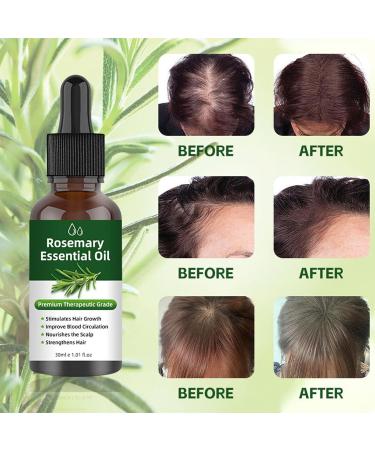 Rosemary Oil for Hair Growth Rosemary Oil for Hair Hair Oil Nourishes the Scalp Hair Strengthening Oil for Fuller Healthier Hair Essential Skin Face Care Eyebrow and Eyelash Growth 100% - Buy Online on GoSupps.com
