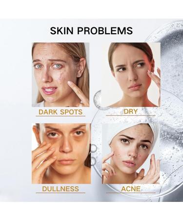Dark Spot Correcting Glow Serum - Niacinamide Serum - Hydrating Face Serum for Women - Dark Spot Remover for Face - Hyaluronic Acid Serum - Improving Skincare - Hydrating Anti-Aging Facial Essence - Buy Online on GoSupps.com