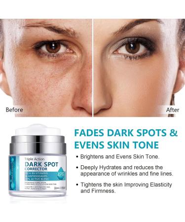 Dark Spot Remover Cream for Face & Body | Blemish Corrector for Age Spots Melasma Freckles & Sun Spots - Effective Dark Spot Treatment for Men & Women - Buy Online on GoSupps.com