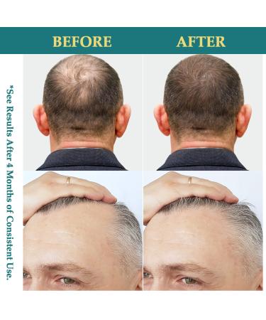 Creip Natural Hair Growth Oil Spray Batana Rosemary Serum - 2 Fl Oz. - Buy Online on GoSupps.com