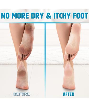 Next Gen U Moisturizing & Cooling Foot Cream (250ml) - Fast Relief for Athlete's Foot, Smelly Feet, Itchy Skin, Eczema, Rough Cracked Heels - Enriched with Peppermint Oil and Urea - Buy Online on GoSupps.com