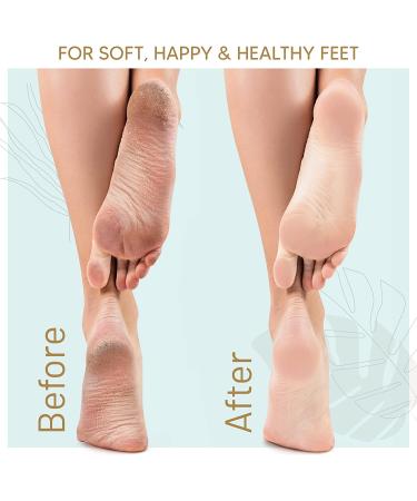 Love Lori Foot Callus Remover Gel 6oz - Professional Pedicure Results at Home - Buy Online on GoSupps.com