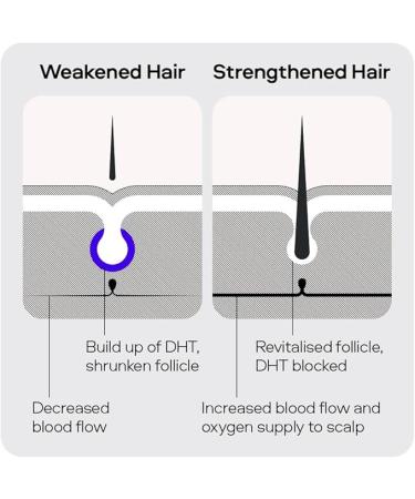 Sons Minoxidil 5% Cutaneous Solution, Hair Regrowth & Thickener Formula - 60ml - Buy Online on GoSupps.com