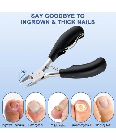 Professional Toenail Clippers for Thick & Ingrown Toenails | Stainless Steel Nail Treatment Tool for Men Women & Seniors - Best Pedicure Tool - Buy Online on GoSupps.com