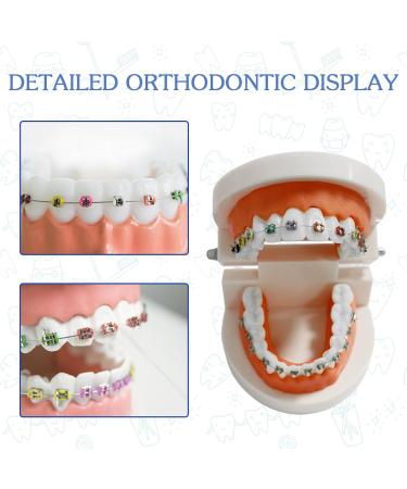Dental Orthodontic Teeth Model with Colorful Braces | Professional Study Tool for Dentistry Students & Orthodontists - Buy Online on GoSupps.com