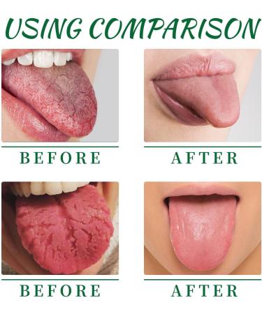Portable Tongue Repair Spray - Relieve Bad Breath Swelling & Pain | Pack of 3 - pH Neutral & Effective Cleaning - Buy Online on GoSupps.com