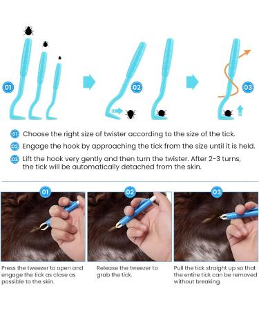 Tick Remover Set for Dogs & Cats - Fast & Safe Tick Removal Tool | Includes Tick Lever Hook & Pliers | Child & Pet Friendly - Navy Blue - Buy Online on GoSupps.com