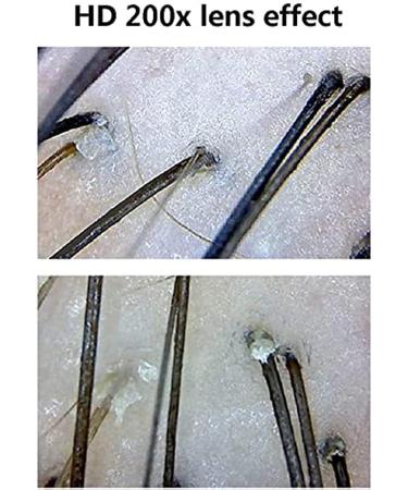 Skin Diagnosis Hair Analyzer 9 Inch LCD Screen Digital Scalp Hair Follicle Tester Facial Skin Detector Skin Diagnosis Scanner System for Home Salon Use Skin Care Instrument - Buy Online on GoSupps.com