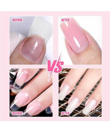 LOKORI Nail Repair Protection Gel 2025 Upgrade Instant Cracked Nail Repair Gel Nail Repair Kit for Cracked Natural Nails Quick Solution Broken Nails Repair Kit for Natural Nails Kit - Buy Online on GoSupps.com