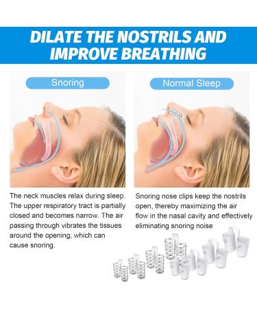 Anti-Snoring Solutions: 2 Rail & 8 Nasal Spreaders | Reusable Sleep Aids for Snoring & Teeth Grinding - Buy Online on GoSupps.com