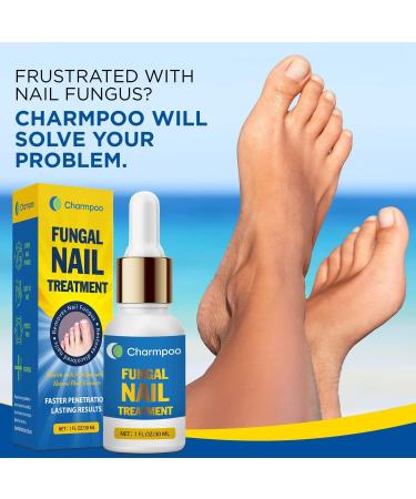 Fungal Nail Treatment - Natural Antifungal Solution for Toe Fungus - 1oz/30ml - Buy Online on GoSupps.com