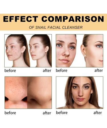 IZBEAUVO Snail Mucin Facial Cleanser Hydrating Cleanser for Gently Cleaning Pores Face Wash Women Facial Wash for Deep Cleansing and Skin Moisturizing Removes Dirt Oil &Impurities without Irritation 1 - Buy Online on GoSupps.com