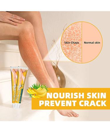  TONGFENG Dry Skin Ointment | 0.7 oz Cracked Skin Repair Ointment | Men's Exfoliating Cream Dry Skin Ointment Fruit Body Lotion Fish Scales Tongfeng - Buy Online on GoSupps.com