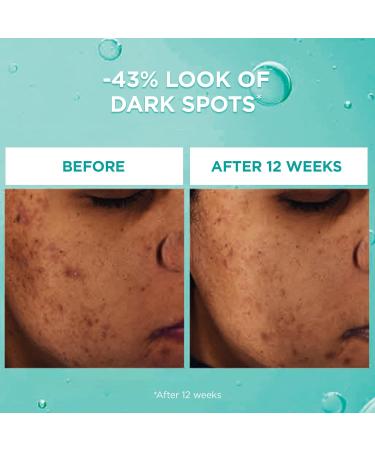 L'Or al Paris Bright Reveal Dark Spot Face Serum with 12% Niacinamide + Ferulic + Amino Sulfonic Acids Reduces the Look of Stubborn Dark Spots For All Skin Tones Skincare 30mL - Buy Online on GoSupps.com