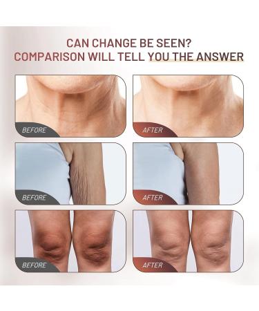 Moisturizing Crepe Fix Cream Tightens and Firms Neck Face & Body Anti Wrinkles for Crepey and Sagging Skin Gift for Women & Men 4.21 Fl Oz 4.21 Fl Oz (Pack of 1) - Buy Online on GoSupps.com