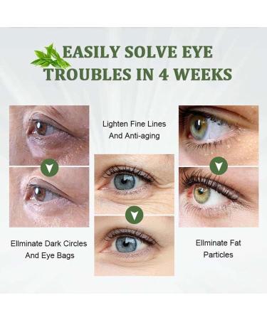 LXYDJPW Avocado Eye Cream Multi-Repair Anti-Aging Eye Cream Instant Firming Eye Cream for Under Eye Bags Dark Circles Puffiness - Buy Online on GoSupps.com