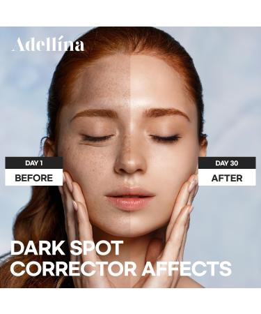 Dark Spot Remover for Face: Dark Spot Corrector for Sun Spots, Age Spots & Uneven Skin Tone - Vitamin C, Alpha Arbutin & Niacinamide for Even Skin Tone (1 Fl Oz) - Buy Online on GoSupps.com