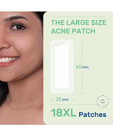 Large Hydrocolloid Pimple Patches - Tea Tree Oil Acne Spot Treatment for Face & Body - Buy Online on GoSupps.com