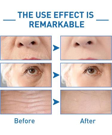 Hyaluronic Acid & B5 Serum - Dark Spot Remover for Face - Hyaluronic Acid Serum for Face for Hydrated - Anti Aging Serum Targets Fine Lines & Wrinkle - Firming and Plumping of Skin All Skin Types (B5) - Buy Online on GoSupps.com