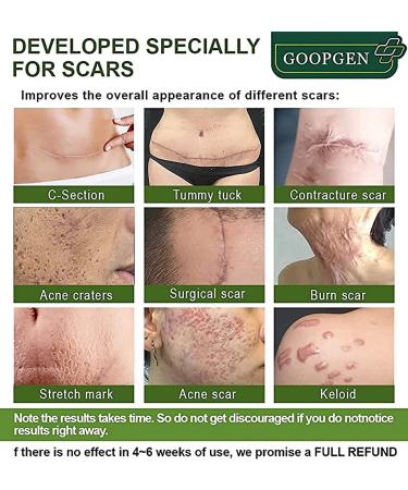 Goopgen Advanced Scar Repair Serum 2023 - Medical Grade Nature Scar Treatment Set - Buy Online on GoSupps.com