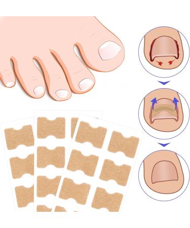 Toen il Correction Sticker 100Pcs: N il Repair P tches Restores Appearance of Discolored or Damaged Nails Foot Care - Buy Online on GoSupps.com