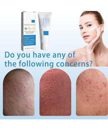 Giugio B5 creams B5 Repair Creme B5 Face Serum B5 Repairing Cream Deep moisturizing face cream soothing and fading acne pressure marks to repair damaged skin - Buy Online on GoSupps.com