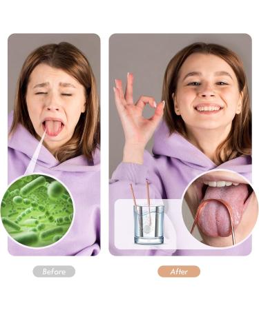 JUIDINTO Tongue Scraper Cleaner 2 Pack - Medical Grade Stainless Steel Tool with Travel Case for Oral Care - Eliminate Bad Breath - Adults and Kids - Buy Online on GoSupps.com