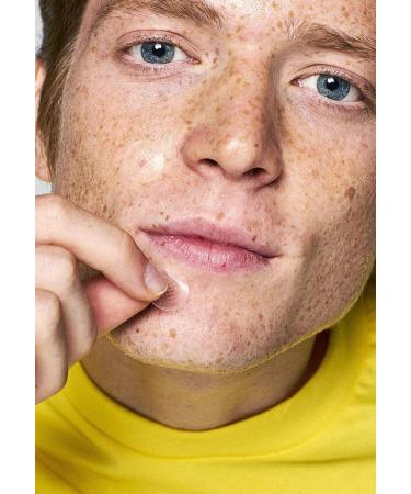 Zitless - 5 Microdart Patches for Early-Stage Pimples | Fast & Effective Acne Treatment - Buy Online on GoSupps.com