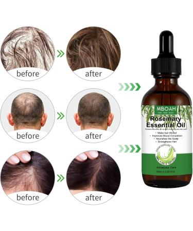 Organic Rosemary Oil Hair Growth - 60ml Natural Essence Pure Essential Oil for Hair Skin and Body Care - Stimulates Hair Growth Strengthens Hair Follicles Promotes Healthy Scalp - Buy Online on GoSupps.com