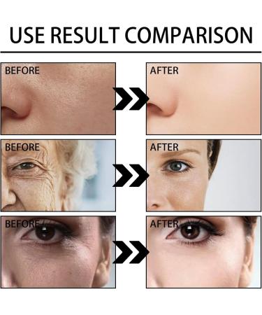 Serum Instant Effect Face Face Serum Plumping Skin Hydrating Serum Instant Face Tightening Facial Essence Anti-Aging Serum Skin Lightening Serum Dark Eye Circle Wrinkle Remover - Buy Online on GoSupps.com