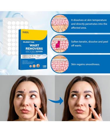 Effective Wart Remover Stickers - Safe Skin Care Solution for All Skin Types | 144 Patches - Buy Online on GoSupps.com