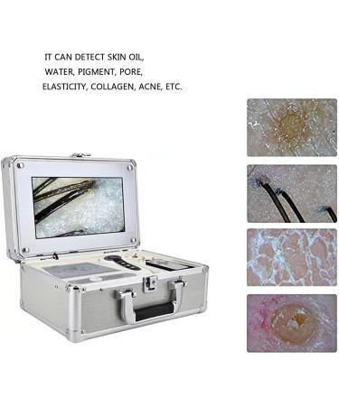 High Definition Scalp Detector Hair Follicle Analyzer Tester Skin Follicle Detector 10in LCD Screen Facial Skin Scanner Digital Skin Hair Scalp Detector for Hair Follicles/Scalp Oil Content/Hair Lo - Buy Online on GoSupps.com