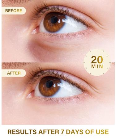 Dr. Pure Under Eye Patches (30 Pairs) - Eye Masks for Dark Circles, Puffy Eyes & Puffiness with 24K Gold - Under Eye Patches for Dark Circles and Puffiness - Buy Online on GoSupps.com