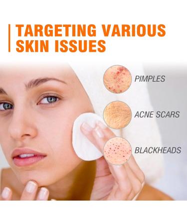 Salicylic Acid Face Moisturizer for Women - Face Cream for Women - Acne Repair Face Cream - Spot Cream for Acne & Pimple - Moisturizer Face with Salicylic Acid - Buy Online on GoSupps.com