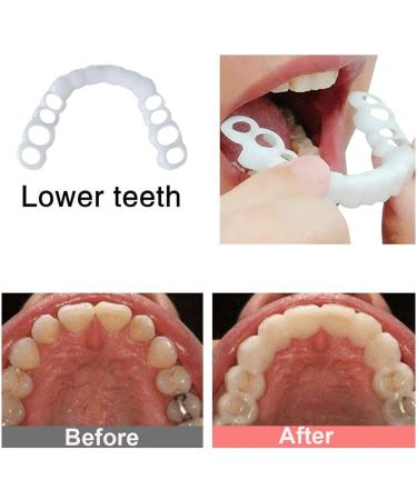 BGZ 4-Piece Cosmetic Teeth Veneers - Instant Perfect Smile | Temporary Fake Teeth for Men & Women | Cover Broken & Missing Teeth - Buy Online on GoSupps.com