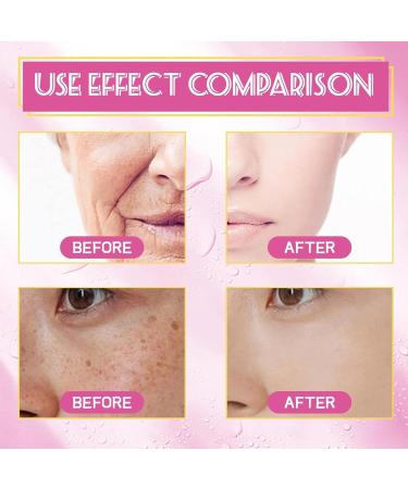 Rose Face Milk Serum Glow Rose Essence Rose Face Care Essence Milk Rose Extract Face Serum Rose Anti Aging Face Moisturizer Rose Face Essence Improve Dull Skin & Soft Skin Tone - Buy Online on GoSupps.com