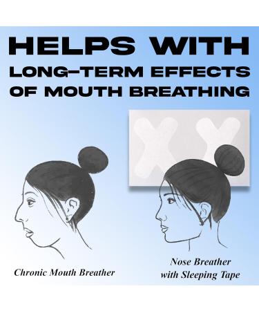 50pc Mouth Tape for Better Sleep, Snoring and Sleep Apnea Relief - Buy Online on GoSupps.com