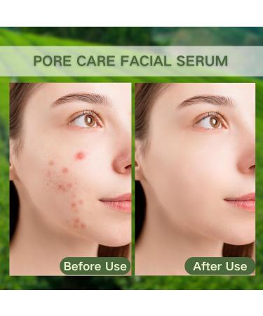 Tea Tree Face Serum - Tea Tree Oil Hyaluronic Acid Serum Dark Spot Correcting Glow Serum Korean Serum Tea Tree Cream Skin Brightening Hydrating Serum For All Skin Types 30ml - Buy Online on GoSupps.com