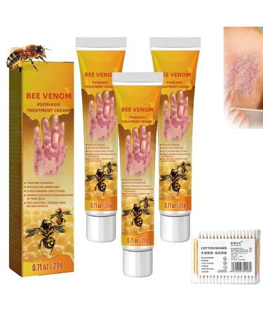ann seeson Youth Bee Venom Psoriasis Treatment Cream New Zealand Bee Venom Professional Psoriasis Treatment Cream Psoriasis Treatment for Skin (3pcs)