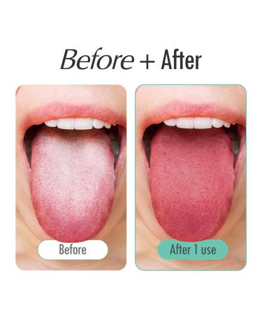 100% Stainless Steel Tongue Scraper | Wipe Tongue Fresh Oral Care | Pack of 2 Tongue Cleaners for Adults | Essential Oral Hygiene Tool - Buy Online on GoSupps.com