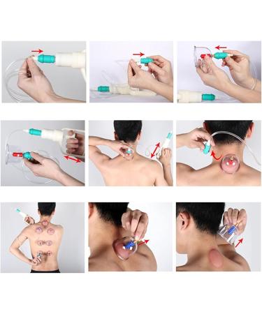 Careforyou 24 Cups Biomagnetic Chinese Cupping Set - Traditional Massage & Acupuncture Therapy - Buy Online on GoSupps.com
